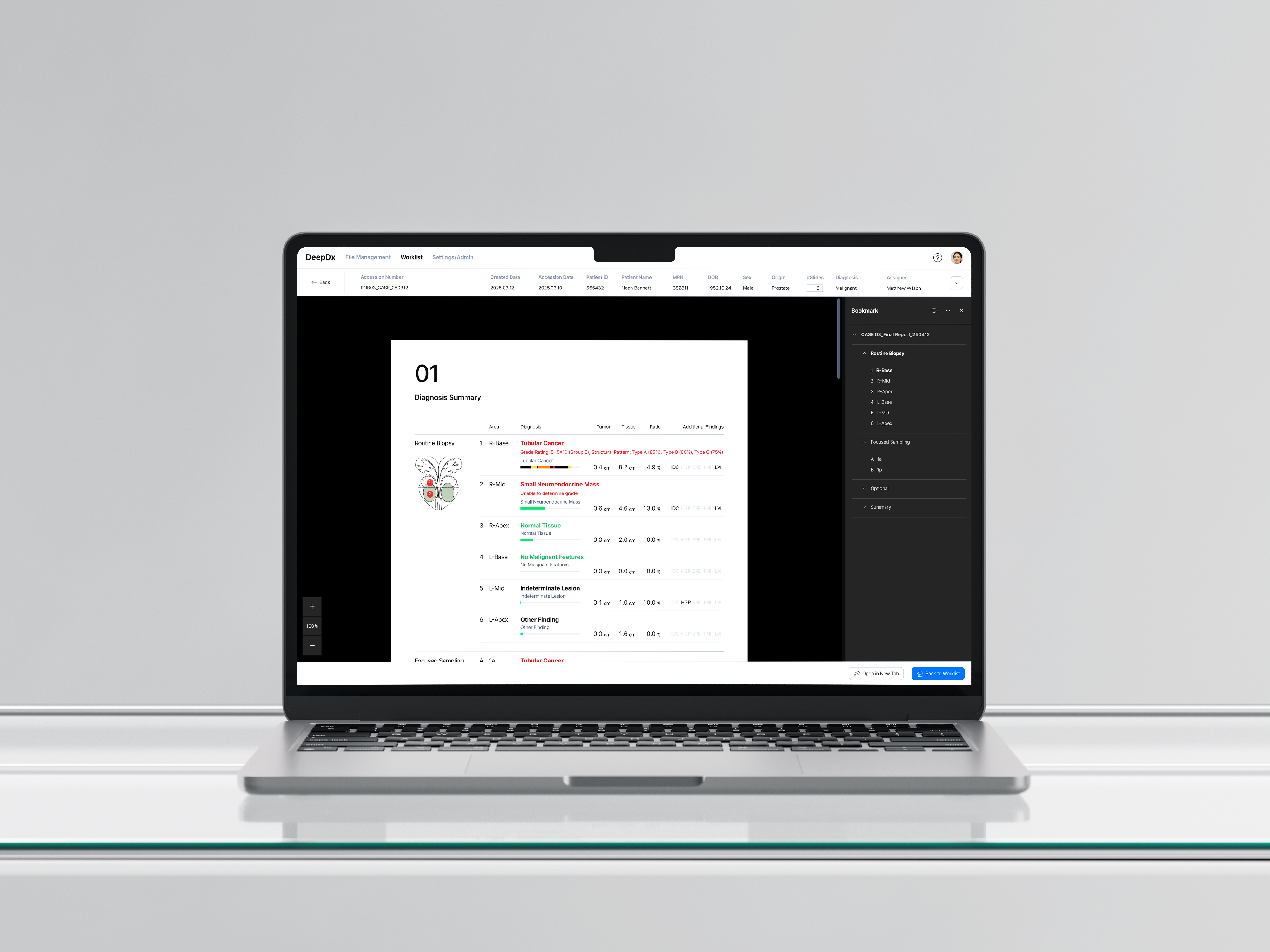 DeepDx Global Pilot